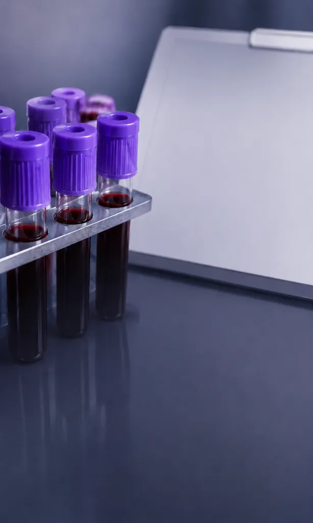 Metabolic Blood Panels - Advanced Clinical Test at our Diabetes Centre Kannur